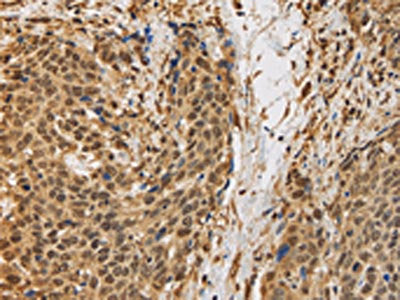 BRAF Antibody