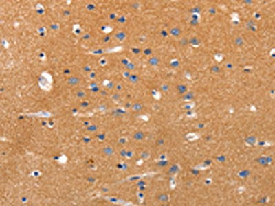 JAK2 Antibody