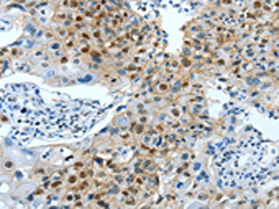 JUN Antibody