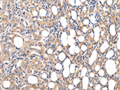 CMKLR1 Antibody