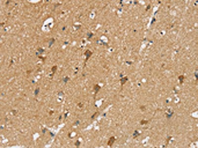 SIAH2 Antibody