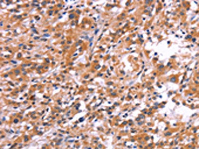 APMAP Antibody