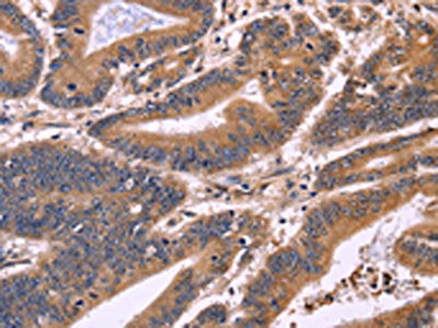 S100A13 Antibody
