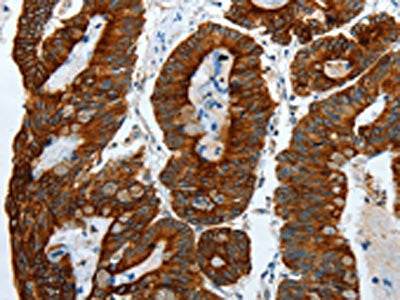 KRT19 Antibody