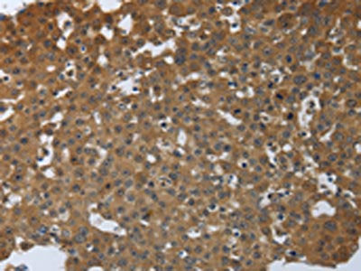 PTPRM Antibody