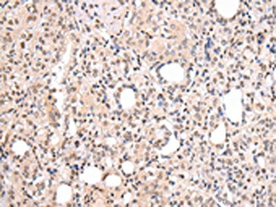 CBX7 Antibody