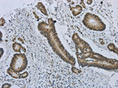 MMP24 Antibody