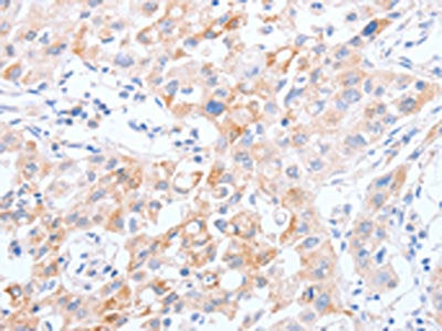 SCARB1 Antibody
