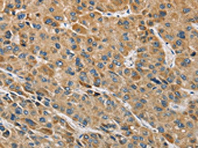 MIP Antibody