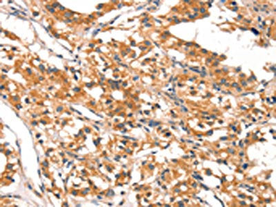 DAB2IP Antibody