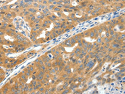 SCN9A Antibody