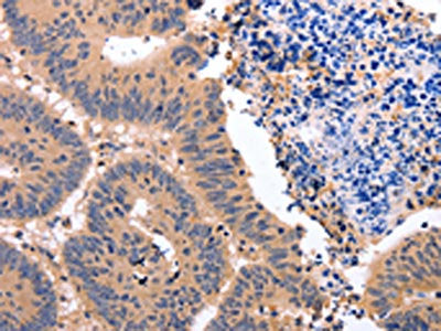 NR3C1 Antibody