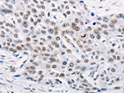 TRIM63 Antibody