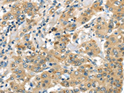 UTS2B Antibody
