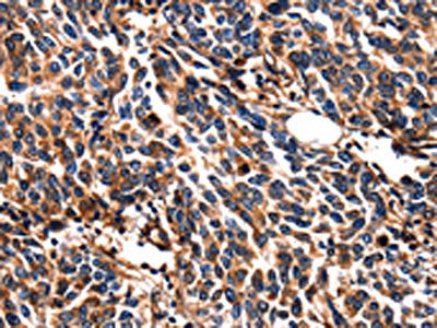 LGALS3 Antibody