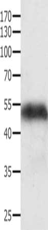 ACPP Antibody
