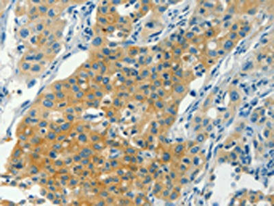 CHRNA2 Antibody