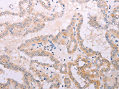 TPO Antibody