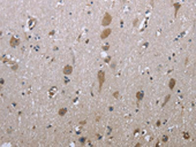 GPC6 Antibody