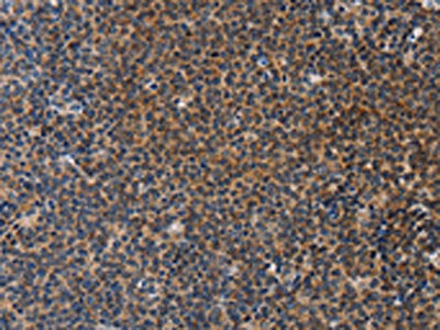 STRADB Antibody