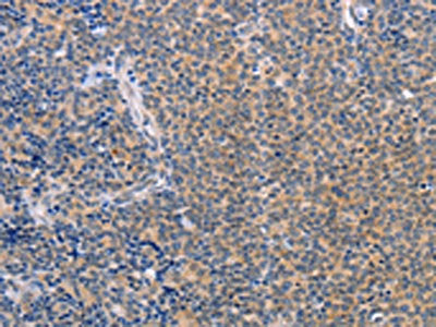 CCL16 Antibody