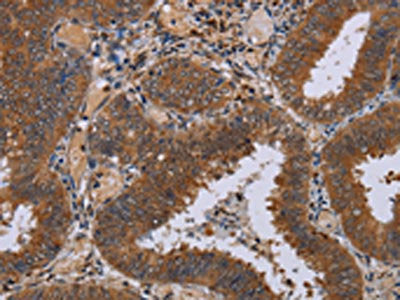 NPTX1 Antibody