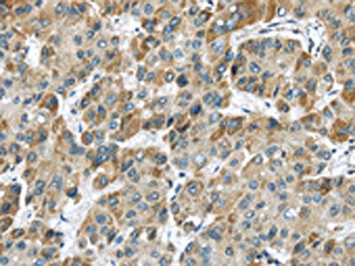 CHRNA1 Antibody
