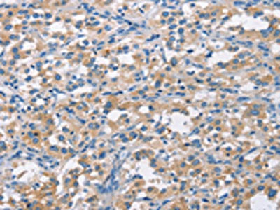 CDC25B Antibody