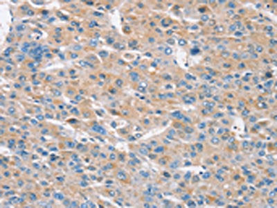 RASA3 Antibody