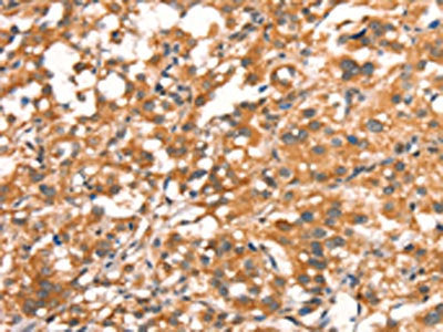 DAP Antibody