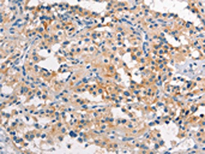 TDGF1 Antibody
