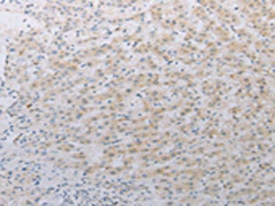 LY75 Antibody
