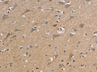 CCR2 Antibody