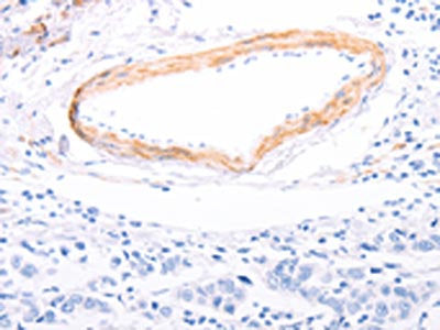 TPM1 Antibody