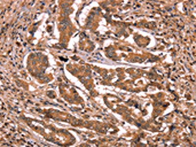 BCL6 Antibody