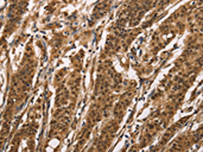 BAI1 Antibody