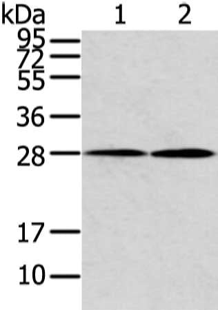 KCNMB1 Antibody