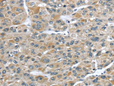 CFAP45 Antibody