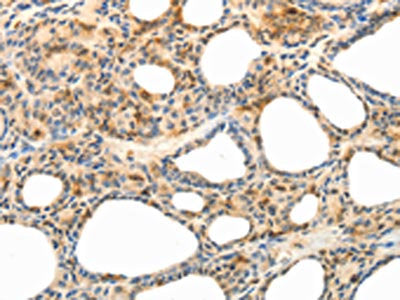CCR8 Antibody