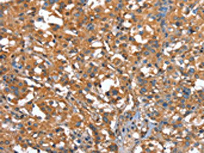 CAPZA1 Antibody