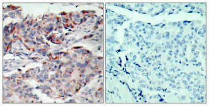 Phospho-JAK2 (Tyr221) Antibody