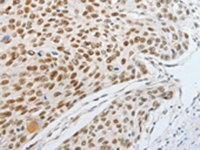 MITF Antibody