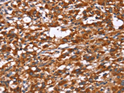 GPHN Antibody