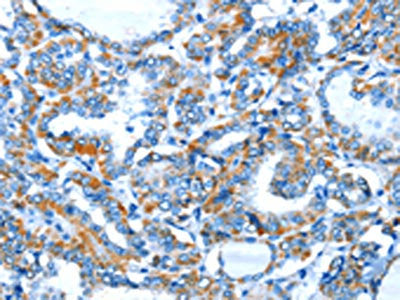 BACE1 Antibody