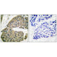 KRT5 Antibody