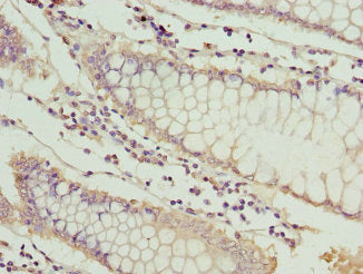 MT1G Antibody