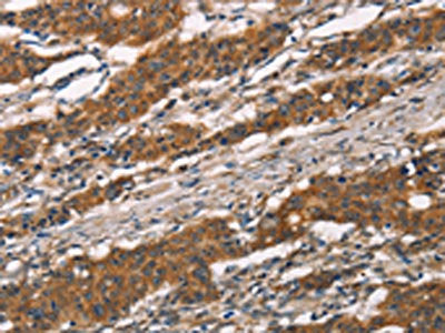 MMP2 Antibody