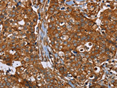 PLEC Antibody