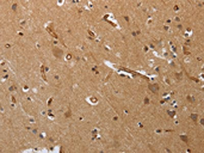 PODXL Antibody