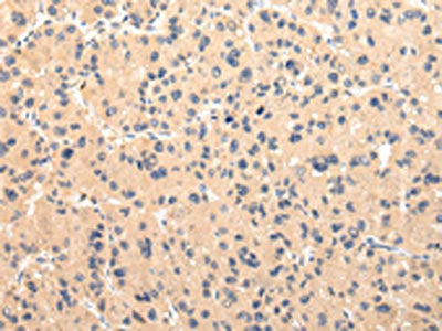 CMKLR1 Antibody